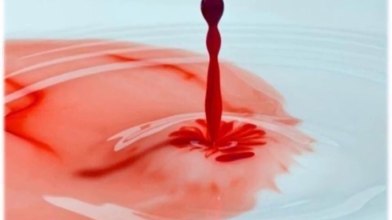 scurgeri sângeroase din penis