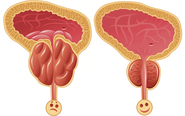 cauzele problemelor de potență la bărbați